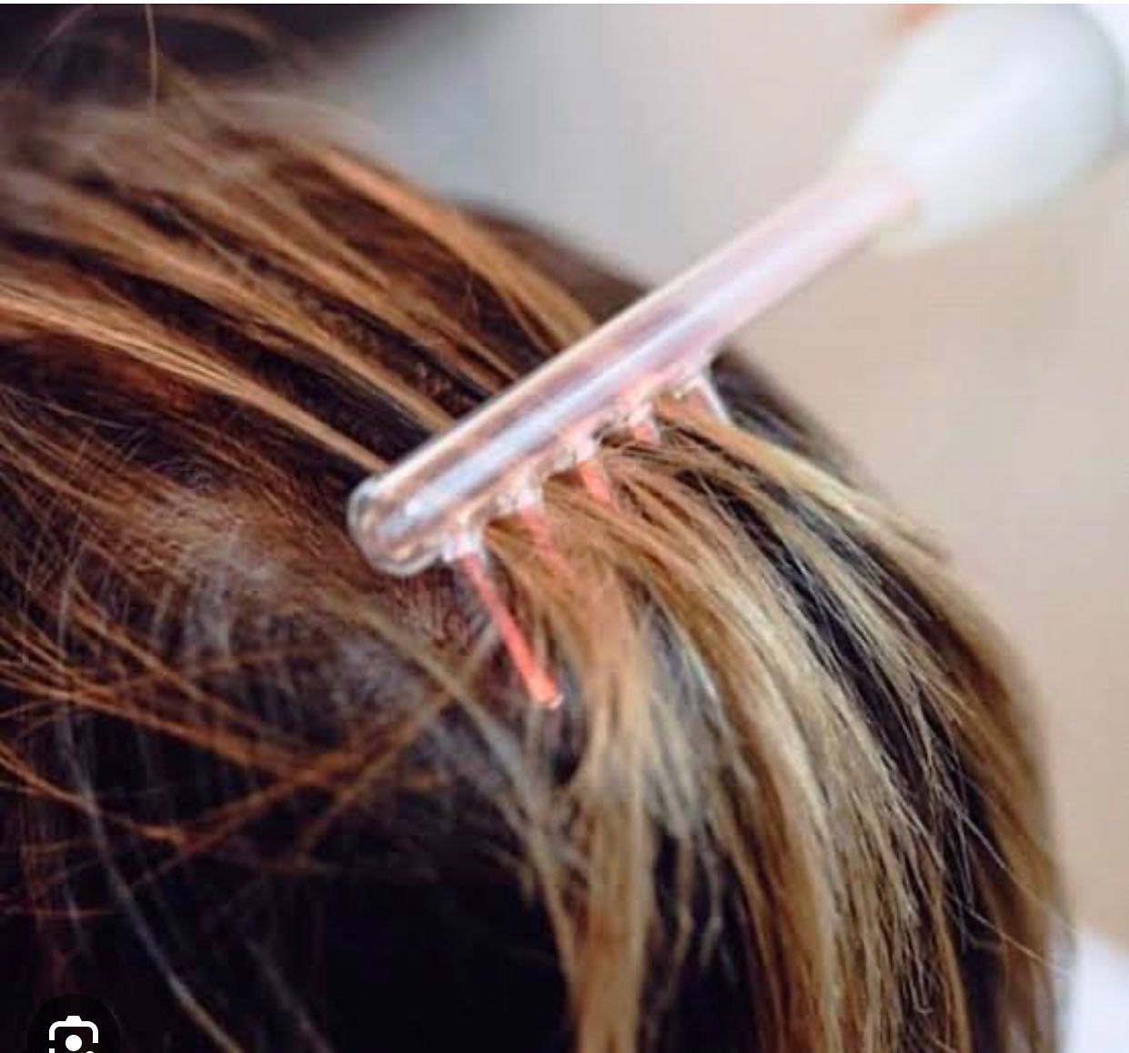 Tratamento Queda Capilar Fabiana Hair